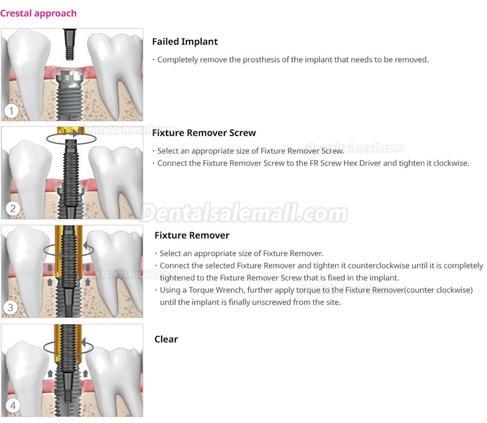 Dental Implant Fixture Removal Kit Remover Screw Torque Ratchet Set